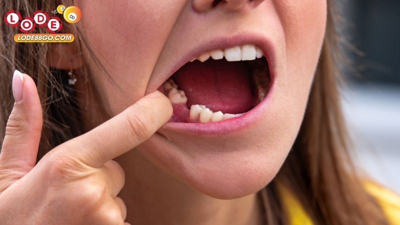 Mơ Thấy Mất Răng: Giải Mã, Ý Nghĩa Và Cách Ứng Dụng 3 Mơ Thấy Mất Răng