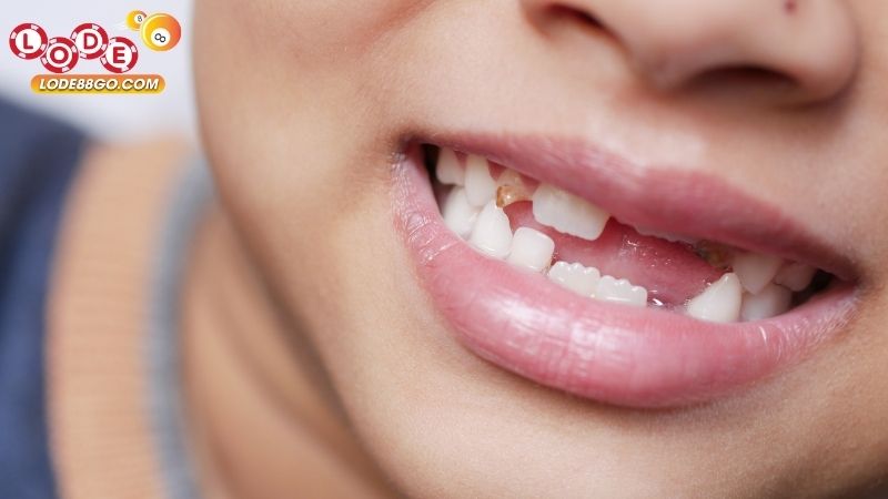 Mơ Thấy Mất Răng: Giải Mã, Ý Nghĩa Và Cách Ứng Dụng 1 Mơ Thấy Mất Răng